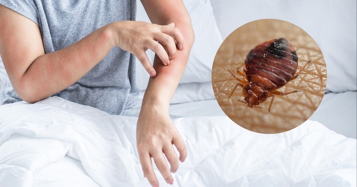 How Often Do Bed Bugs Need to Feed to Survive