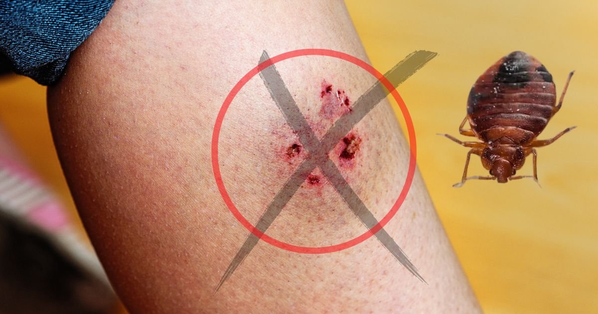 How to Not Be Bitten by Bed Bugs