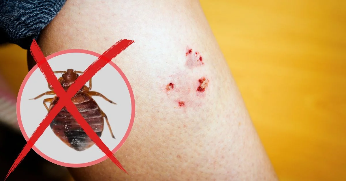 How to Prevent Bed Bugs from Biting You