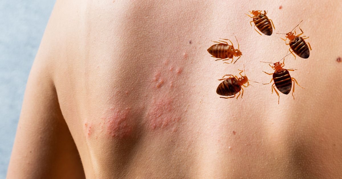 How to Protect Yourself from Bed Bugs How to Protect Yourself from Bed Bugs