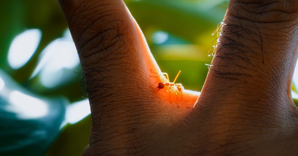 Are You Supposed to Pop Ant Bites