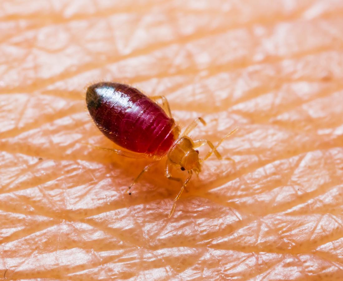 How to Contain Bed Bugs