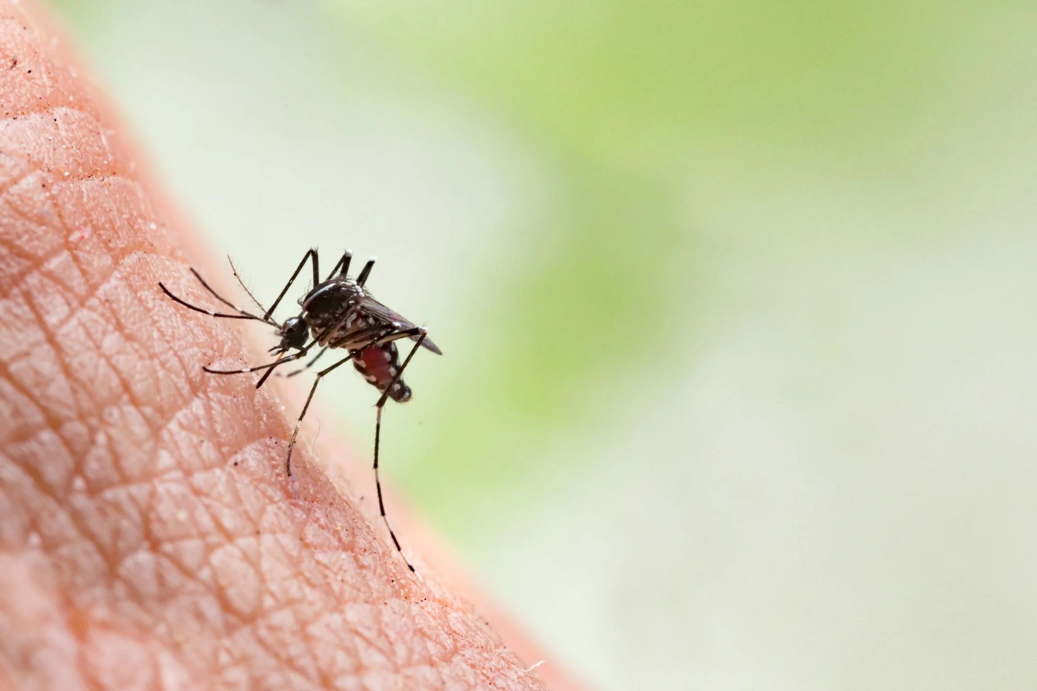 easiest way to get rid of mosquito bites Easiest Way to Get Rid of Mosquito Bites?
