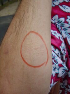 What Happens When Spider Pees on Your Skin? Shocking Truths!