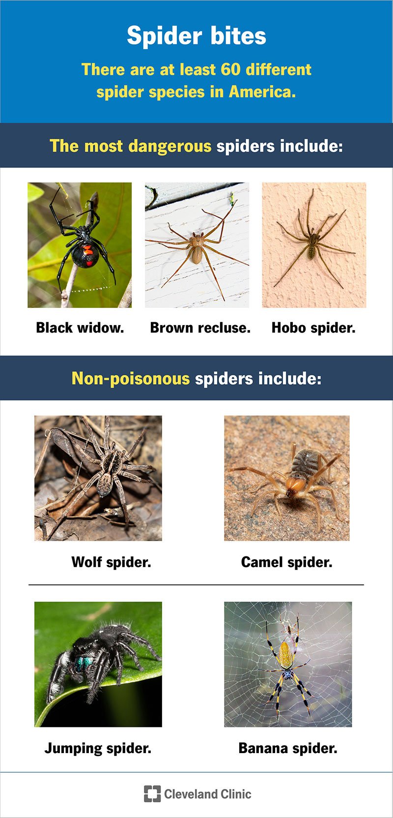 What to Do If Spider Bites You?