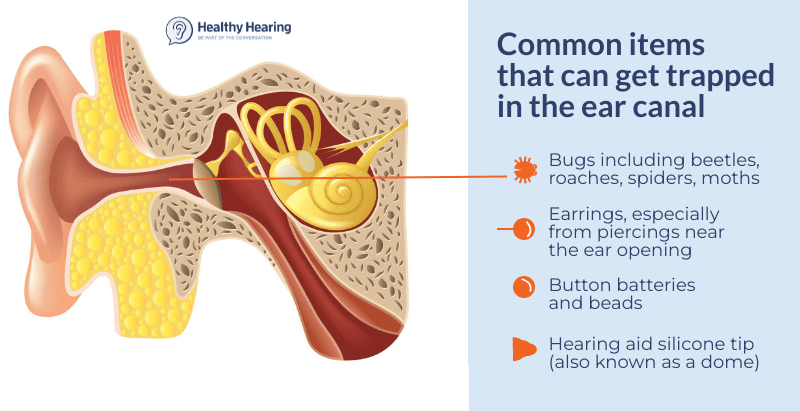 What to Do If Spider in Ear?